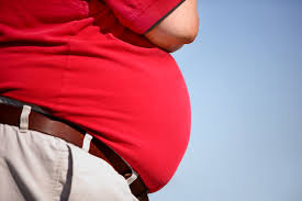 Obese person