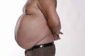 Another Obese person